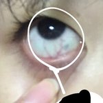[조언부탁해] 이거 결막염이야? 이상한사진아님진짜