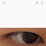 쌍수<b>전후</b>인데...