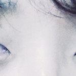 [댓글부탁해] 쌍수<b>절개</b>한지 8개월 됐음