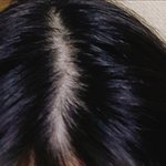 [조언부탁해] 아 나 진짜 <b>탈모</b>땜에 미치겠음ㅜ