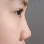 [조언부탁해] 얘들아 <b>코</b>좀 봐줘 (사진첨부 안돼서 다시 올려!)