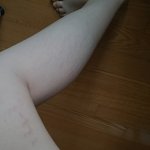 [조언부탁해] 얘들아 이거 병이야??ㅠㅠㅠㅠ