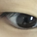 쌍수 관련 해서 ㅠㅠ