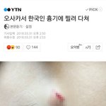 ㄹㅇ로 일본좋아하는애들 솔직히 미개해보여