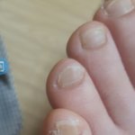 [꼭조언부탁] 저같은 <b>발톱</b>을 가진분 있으신가요..