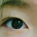 [댓글부탁해] 쌍수 윗트임 할까말까 추반좀