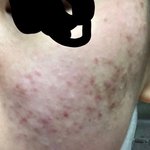 [조언부탁해] 피부화장좀 봐주라 ㅠㅠㅠ