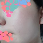 [댓글부탁해] <b>파데</b> 바꾸고 피부 뒤집어짐 어떡해