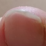 ?????나 <b>발가락</b> 썩은거야?