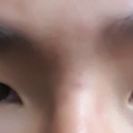 [꼭조언부탁] 남자 <b>눈</b> <b>성형</b> 어떻게할까요