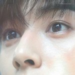 [드루와] 입툭튀때문에 교정한 판녀들드루와줘ㅠㅠ