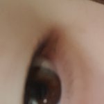 [댓글부탁해] 나 쌍커<b>풀</b> 수술 해야겟지?ㅋㅋㅋ