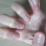 [댓글부탁해] 이 손톱 <b>정상범위</b>까지 기를려면 얼마나 걸릴거같음?