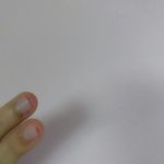 손톱이랑 손<b>밑살</b>을 뜯는 버릇이 있어