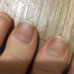 나<b>발톱</b>개길지(혐주의)