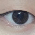 [댓글부탁해] 나 무쌍인데 쌍수할까 말까 (<b>사진o</b>)