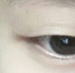 [댓글부탁해] 나 앞트임 꼭 해야되나?