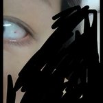 각막에 상처난듯