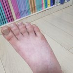 <b>발사진</b> 주의))지금 내 피부색....보르딩딩
