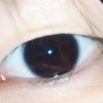 쌍수하면 어떨거<b>가태</b>