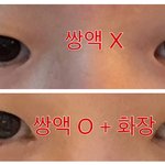 쌍수해도 ㄱㅊ겟지?