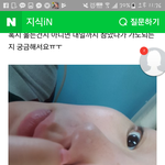 나 눈 이렇게 됐는데 어캐야 해 ㅜㅡㅠ