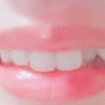 <b>치아</b>교정 해야겠지,,?