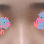 이렇게생긴코는 <b>쉐딩</b> 어떻게해야함