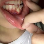 <b>이빨</b>이 <b>잇몸</b>에 났어