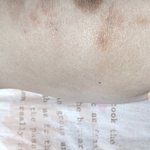 나 왜 <b>무릎뼈</b> 튀어나옴 ㅋㅌㅌㅌㅌ