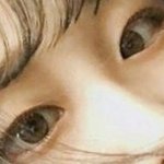 쌍수 <b>전후</b> 뭐가 나아?