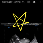 12주 <b>각도</b>법 후기 남깁니다