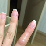 야 나손 조카부었어 <b>개심</b>각