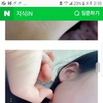 [꼭조언부탁] <b>증상</b>을 알고 싶어요