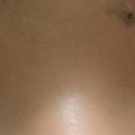 [이것좀봐줘] 남자 눈매교정(쌍수) 질문하러왔소.