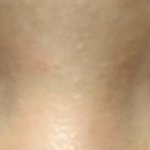 [댓글부탁해] 쌍수했는데 <b>삼백</b>안 된거같애