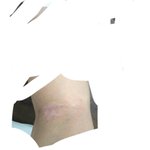 [드루와] 나 아토피 <b>흉터</b> 있는데