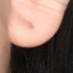 피어싱 뺀 자리 상처남은거 어떡해??
