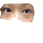 다크<b>서클</b> 진짜 뭐야