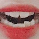 [19] 친구가 자꾸 꼽줌;;;