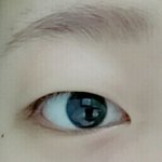 나 무쌍인데 쌍수해야할까