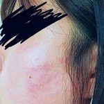 [개깊은빡침] +추가+추가(사진추가)수변공원에서 헌팅거절로 뺨 맞았어요