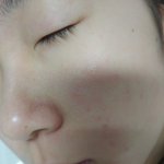 [댓글부탁해] 쌩얼혐)나볼<b>코에</b>땀구멍오지게많고큰데