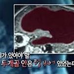 내머리속이 거미줄이면