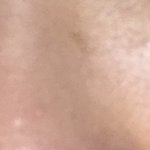 [댓글부탁해] 이런 피부 어떻게 해??