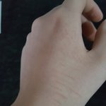 [댓글부탁해] 무슨 <b>흉터</b>같냐