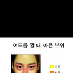 여드름 짤 때 아픈 <b>부위</b> BEST 3