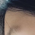 [조언부탁] 나 <b>코</b> 수술할까ㅠㅠㅠㅠㅠ (사진주의)