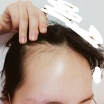 미성년자도 <b>타투</b>할 수 있냐..