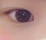 나 눈 어때